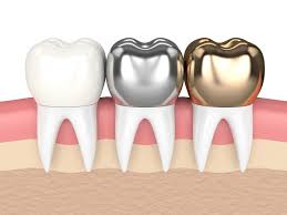 dental cap crown